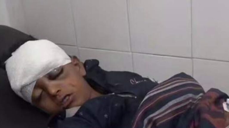 یمن میں سعودی بمباری سے زخمی ہونے والا بچہ اسپتال میں زیر علاج